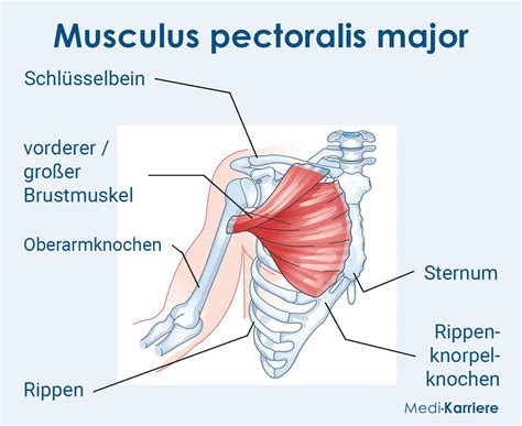 pectoralis major lappen|Der Pectoralis